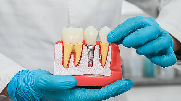 Dental Implant Specialist in NJ