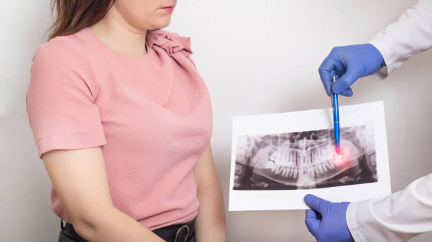 Wisdom Teeth Removal Procedure