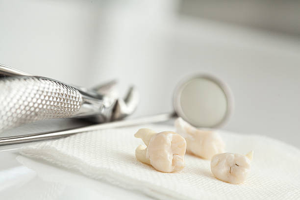 Wisdom Teeth Removal